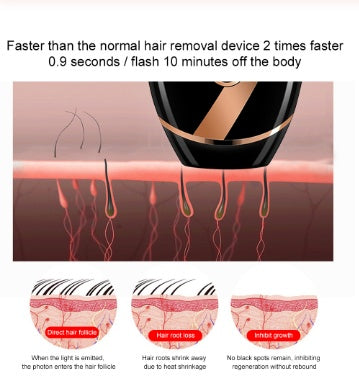 Épilateur laser professionnel – Blanchiment et douceur de la peau