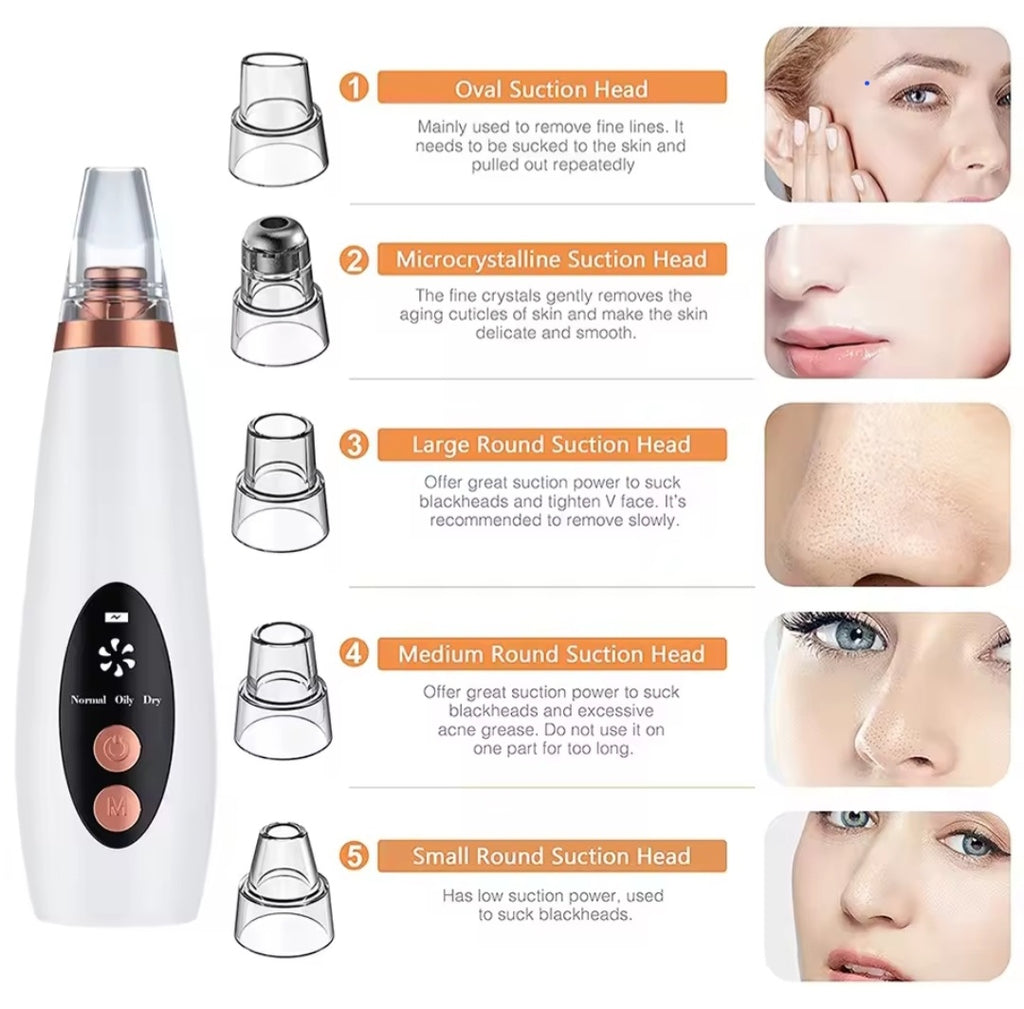Extracteur de points noirs et aspirateur de pores | Outil facial rechargeable USB
